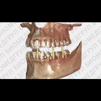 Exocad DICOM viewer  средство просмотра DICOM файлов