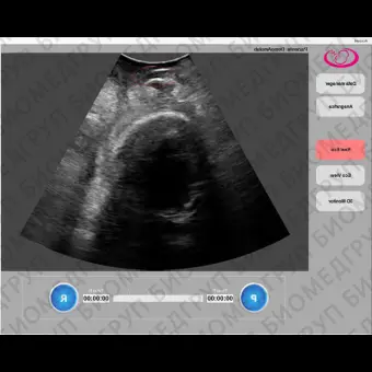 Программное обеспечение для ультразвуковых исследований Amolab Suite