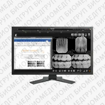 Медицинское программное обеспечение PaxeraDental