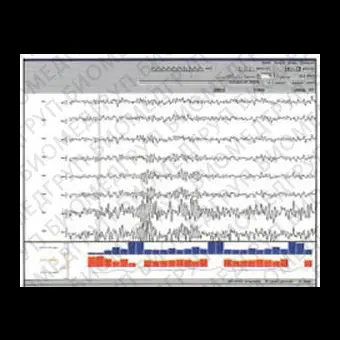 Программное обеспечение для EMG SleepSign