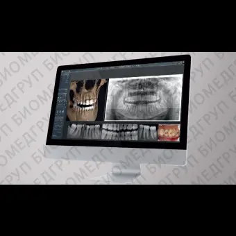 Программное обеспечение для обработки снимков зубов SIDEXIS 4