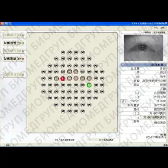 Офтальмологический периметр MD820A