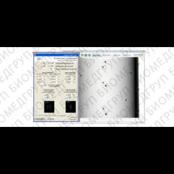 Программное обеспечение для медицинских снимков CBCT