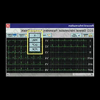 Электрокардиограф для спокойного состояния Cardipia 800 H smart