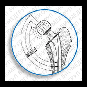 Восстановительный протез бедренной кости SP II