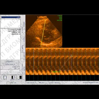 Программное обеспечение для ультразвуковых исследований Ecoestres