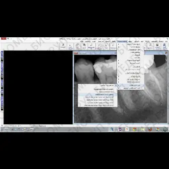 Программное обеспечение для обработки снимков зубов Prof. Suni