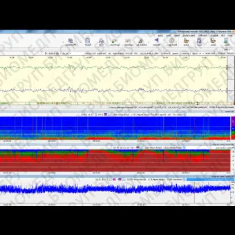 Монитор пациента для ЭЭГ NEUROMONITOR