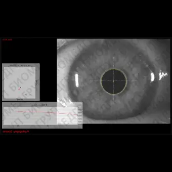 Роговичный топограф OSIRIST