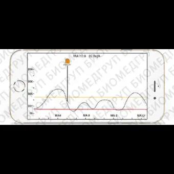 Приложение iOS для мониторинга Dexcom G5 Mobile App