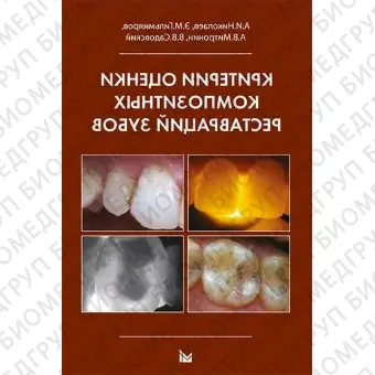 Критерии оценки композитных реставраций зубов. / Николаев А.И.