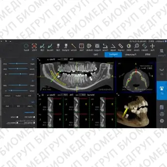 Программное обеспечение для обработки снимков зубов SmartV Pro
