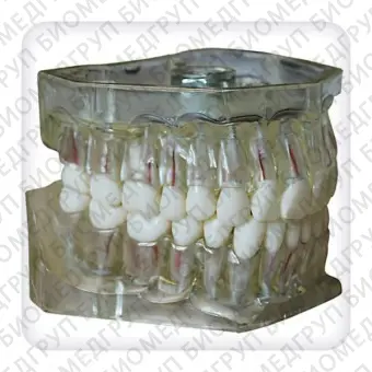 Модель верхней и нижней челюстей с 32 интактными зубами для эндодонтии