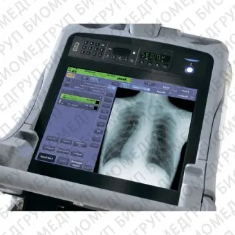 Shimadzu MobileDaRt Evolution Палатный рентгеновский аппарат