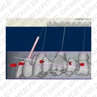 Программное обеспечение для стоматологии CORITEC ICAM V5