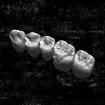 Программное обеспечение для восстановления зубов Zirkonzahn.Library