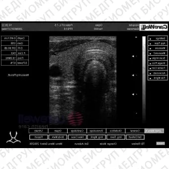 Ультразвуковой сканер на платформе CUS9618CII