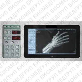 Remodix 9507 Цифровой палатный рентгеновский аппарат