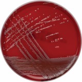 Staphylococcus spp